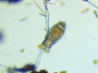 Moss Safari on World Microscopy Day: Five Ways of Seeing a&nbsp;Rotifer