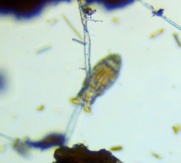 Moss Safari on World Microscopy Day: Five Ways of Seeing a&nbsp;Rotifer